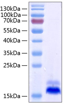 Recombinant Human TNFRSF10B/DR5/TRAIL-R2/CD262 Protein