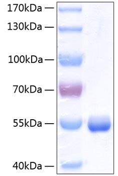 Recombinant Human Retinol-binding protein 4/PRBP Protein