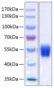 Recombinant Human Serpin A1/Alpha-1-antitrypsin Protein