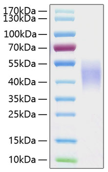 Recombinant Human Fc-gamma RIII beta/FCGR3B/CD16b Protein