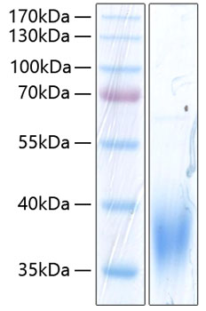 Recombinant Human SLAMF7/CRACC/CD319 Protein