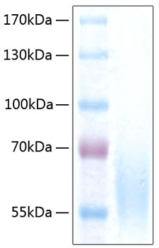 Recombinant Human CEACAM1/CD66a Protein