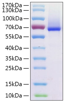 Recombinant Human Glypican-1/GPC1 Protein