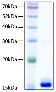 Recombinant Human Transthyretin/TTR Protein