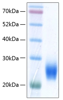 Recombinant Human NKG2D ligand 2/ULBP2 Protein