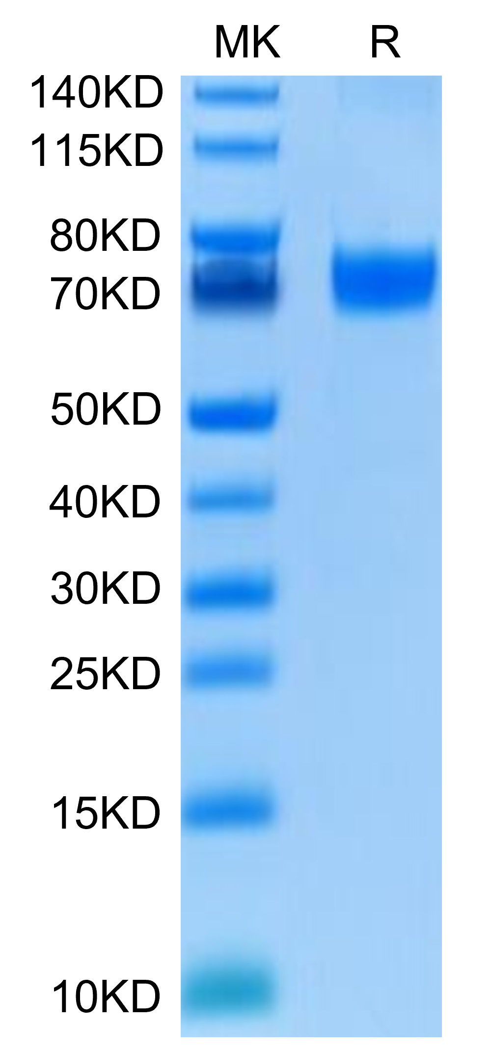 Recombinant Human B7-H5/Gi24/VISTA Protein