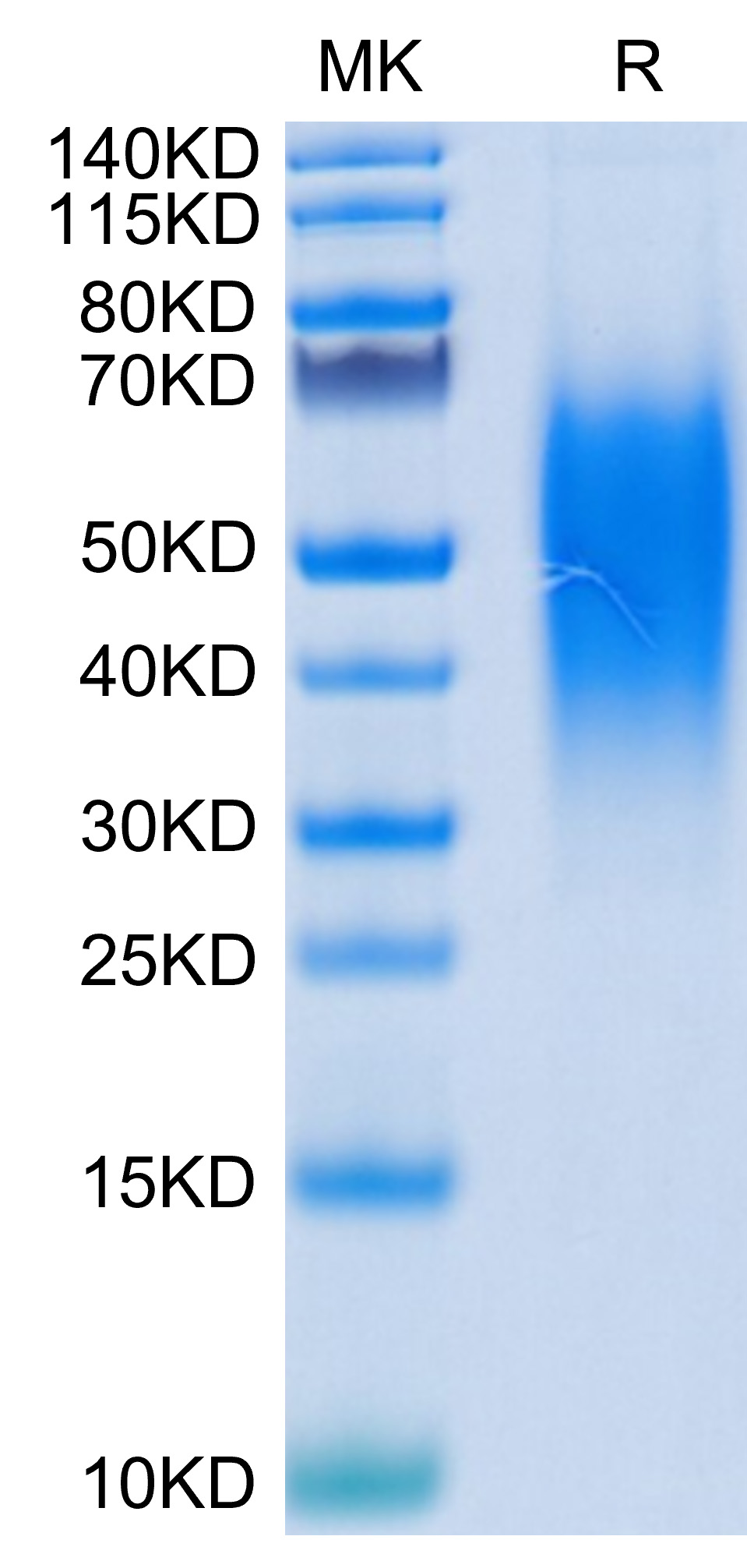 Recombinant Human B7-H5/Gi24/VISTA Protein