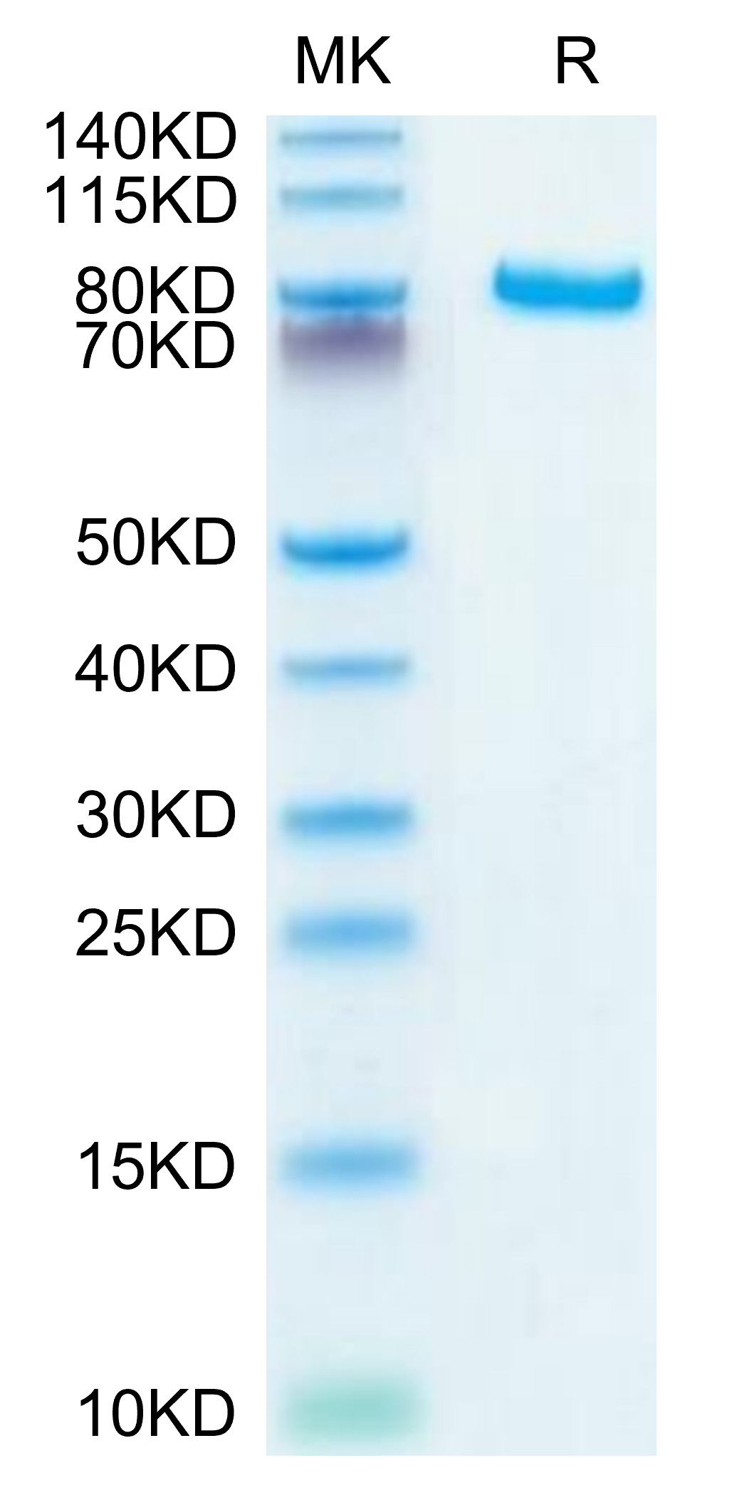 Recombinant Human DLL4 Protein