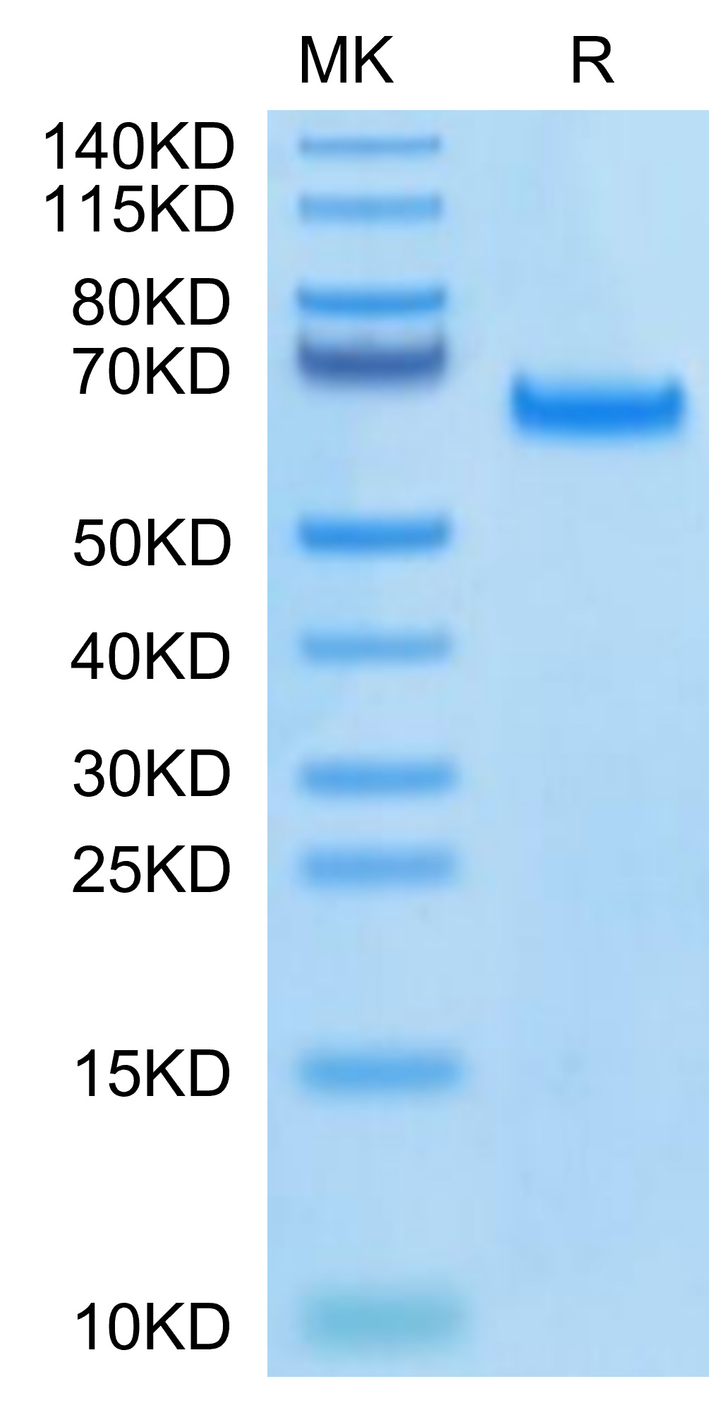 Biotinylated Recombinant Human DLL4 Protein