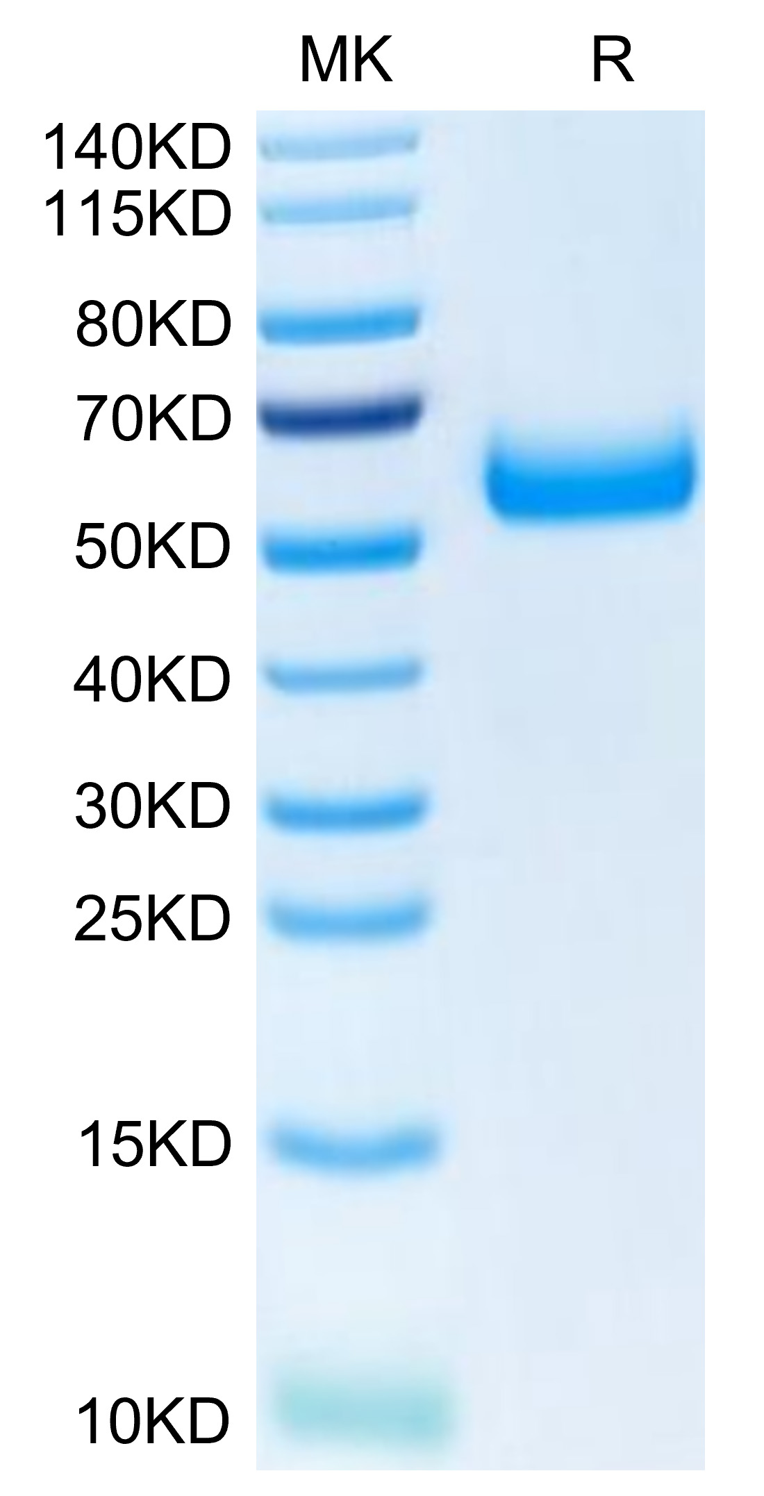 Recombinant Human TREM2 Protein