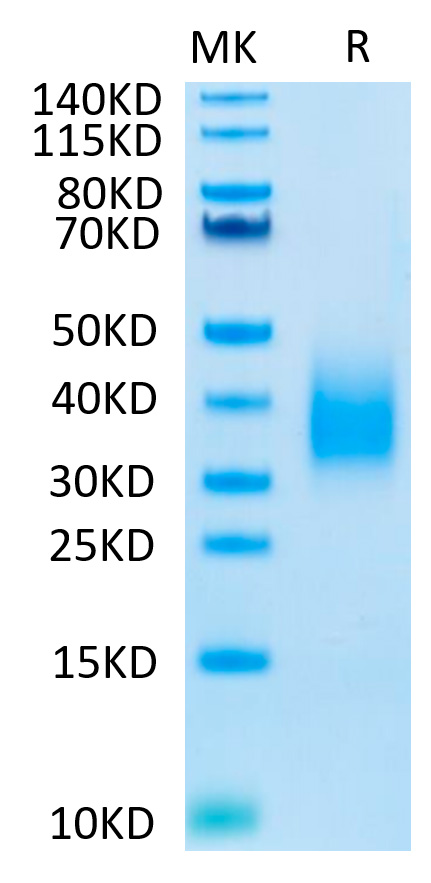 Biotinylated Recombinant Human TREM2 Protein