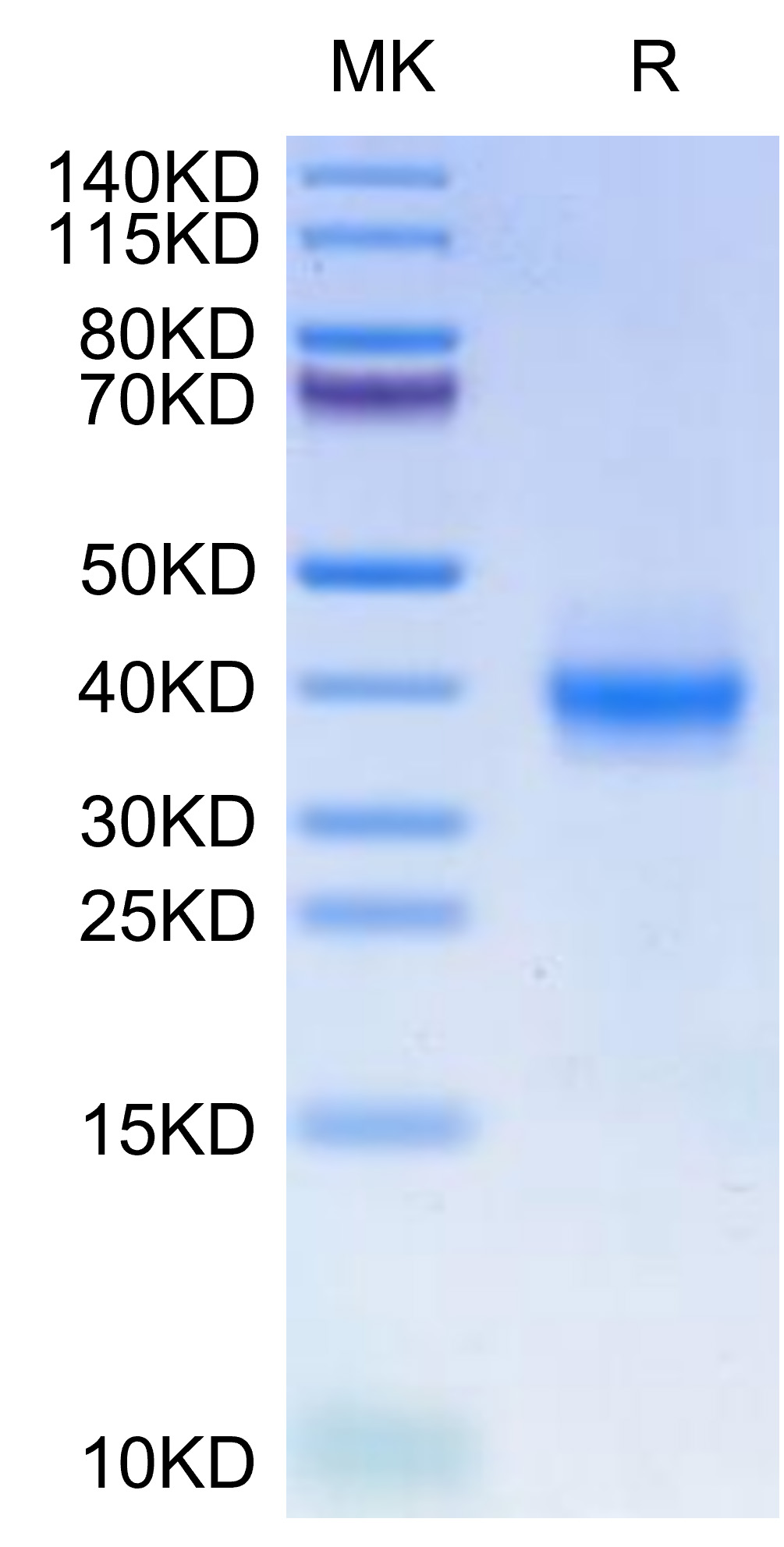 Recombinant Human B7-H1/PD-L1/CD274 Protein