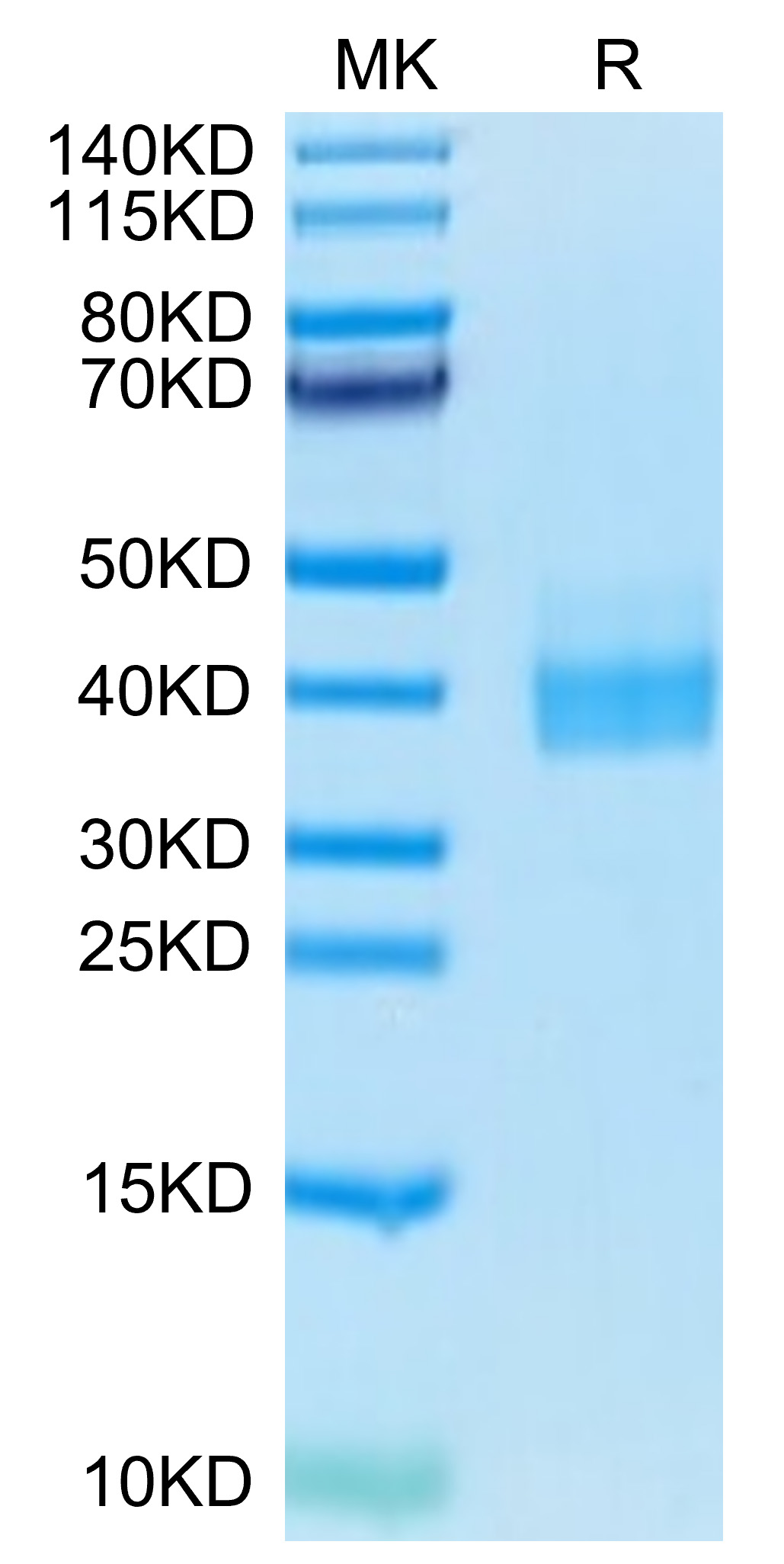 Biotinylated Recombinant Human B7-H1/PD-L1/CD274 Protein