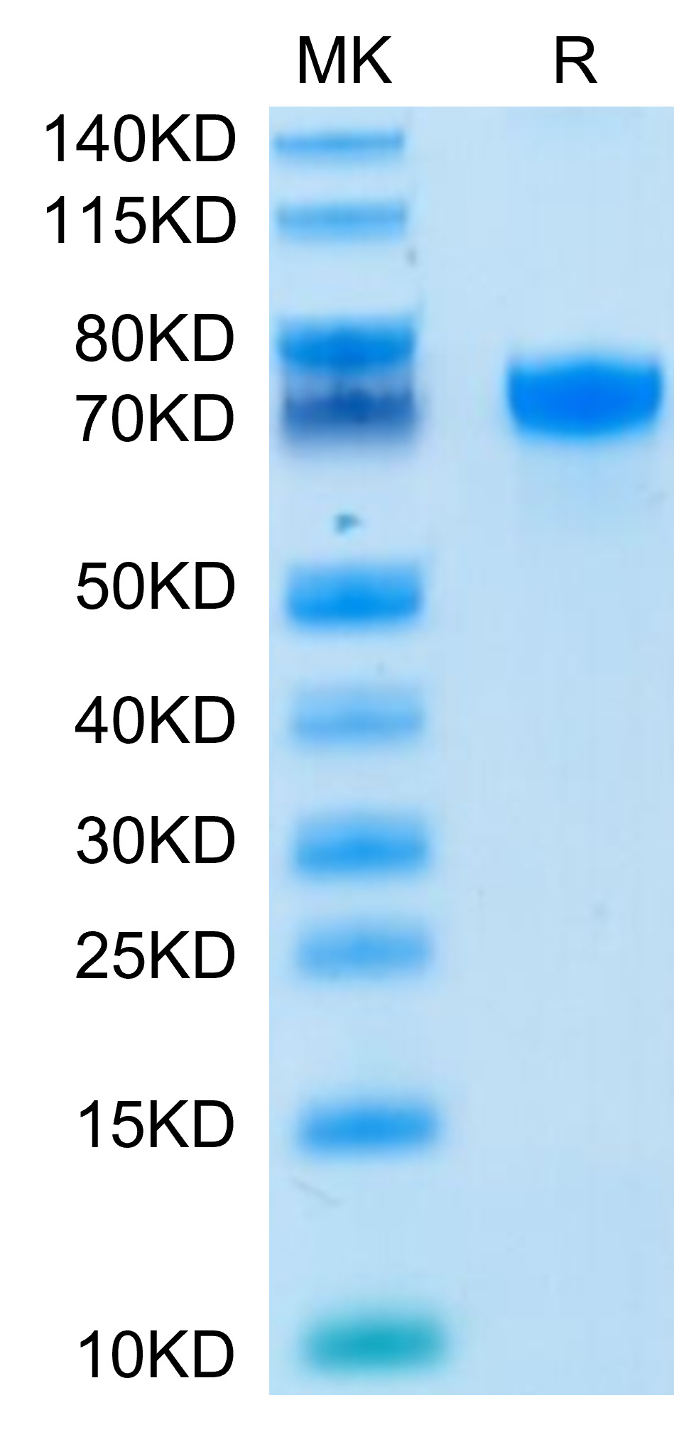 Recombinant Human B7-H1/PD-L1/CD274 Protein