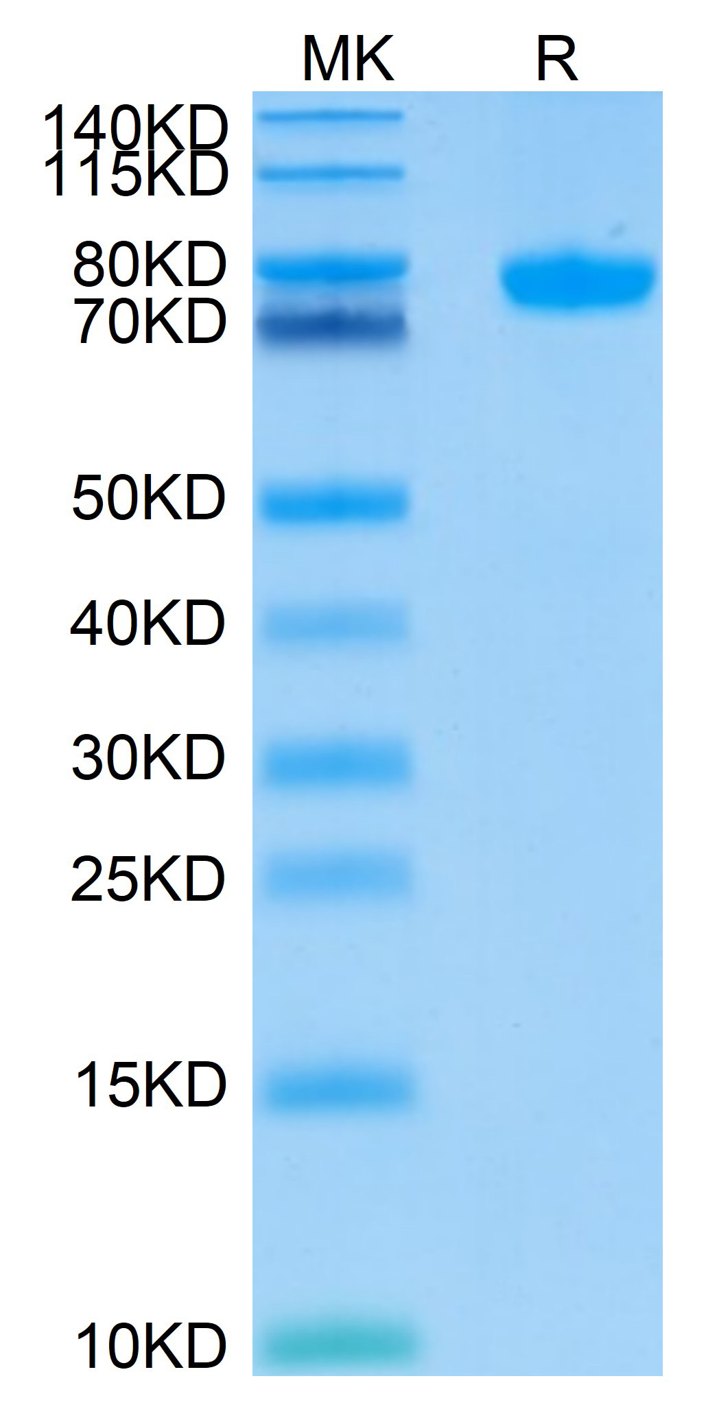 Recombinant Human Siglec-8 Protein