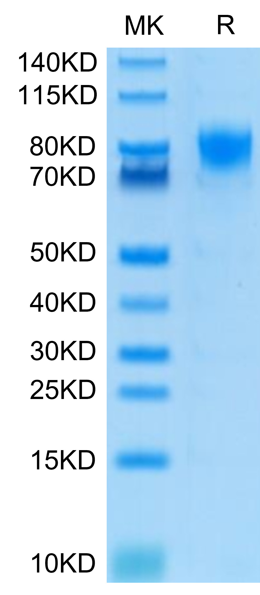 Recombinant Human DNAM-1/CD226 Protein