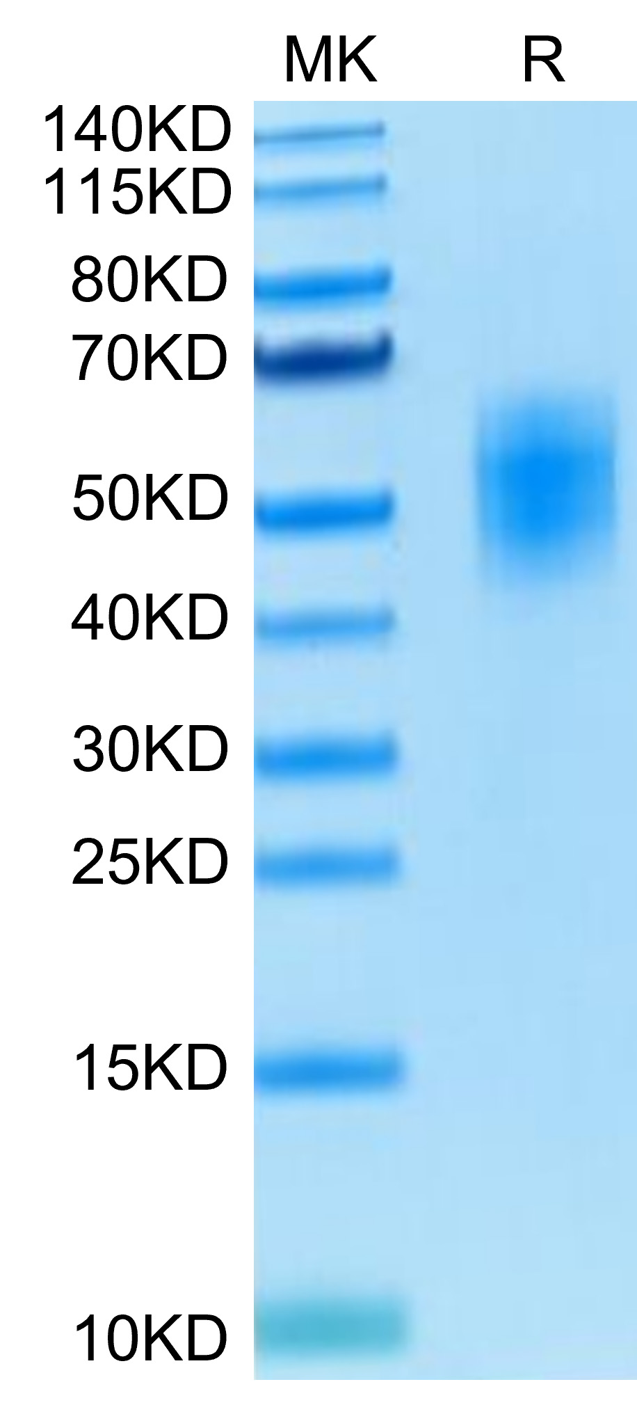 Recombinant Human DNAM-1/CD226 Protein