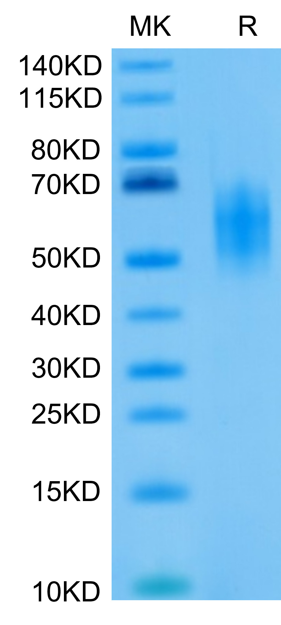 Biotinylated Recombinant Human DNAM-1/CD226 Protein