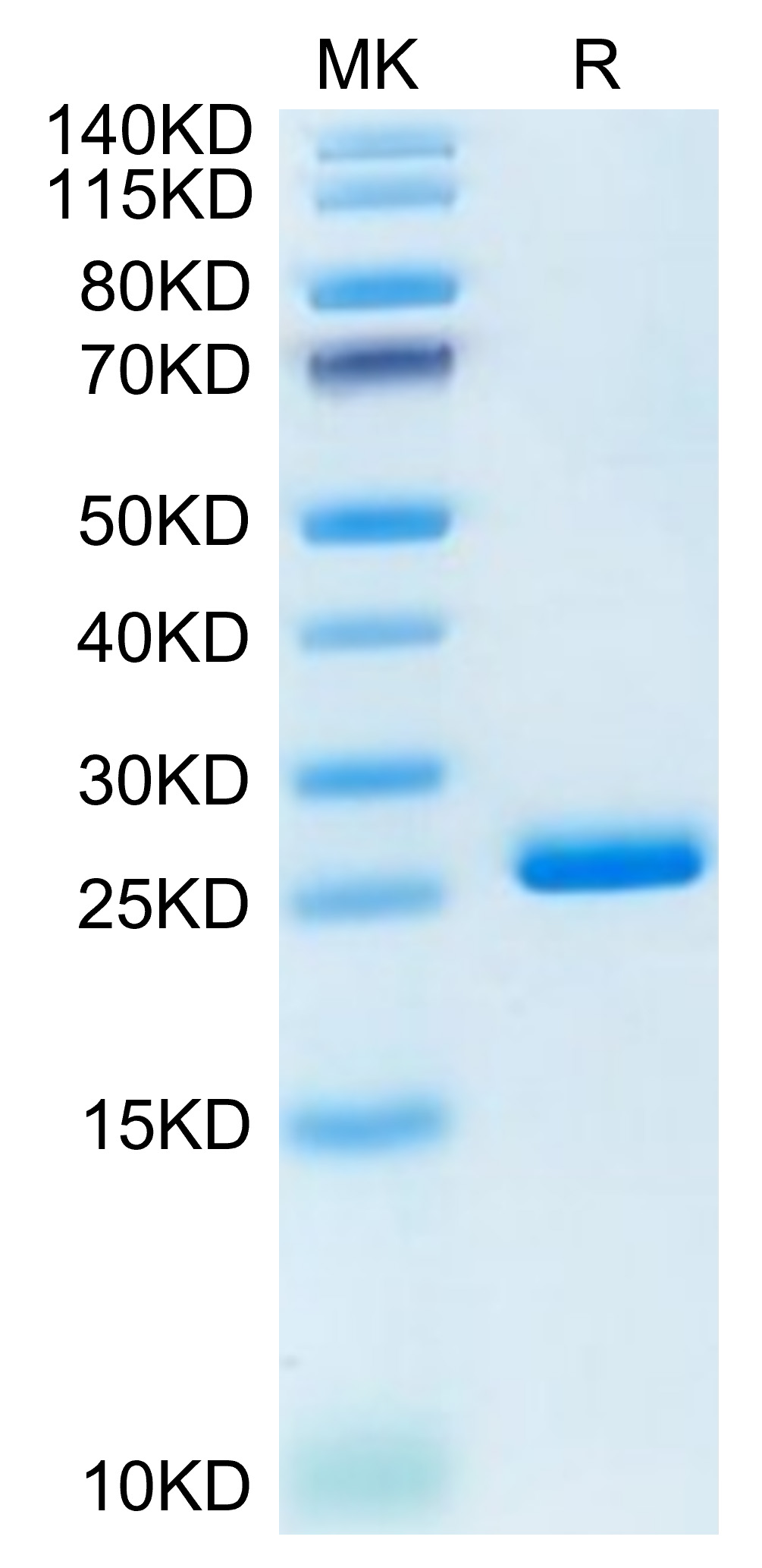 Recombinant Human LILRB2/ILT-4/CD85d Domain1&2 Protein