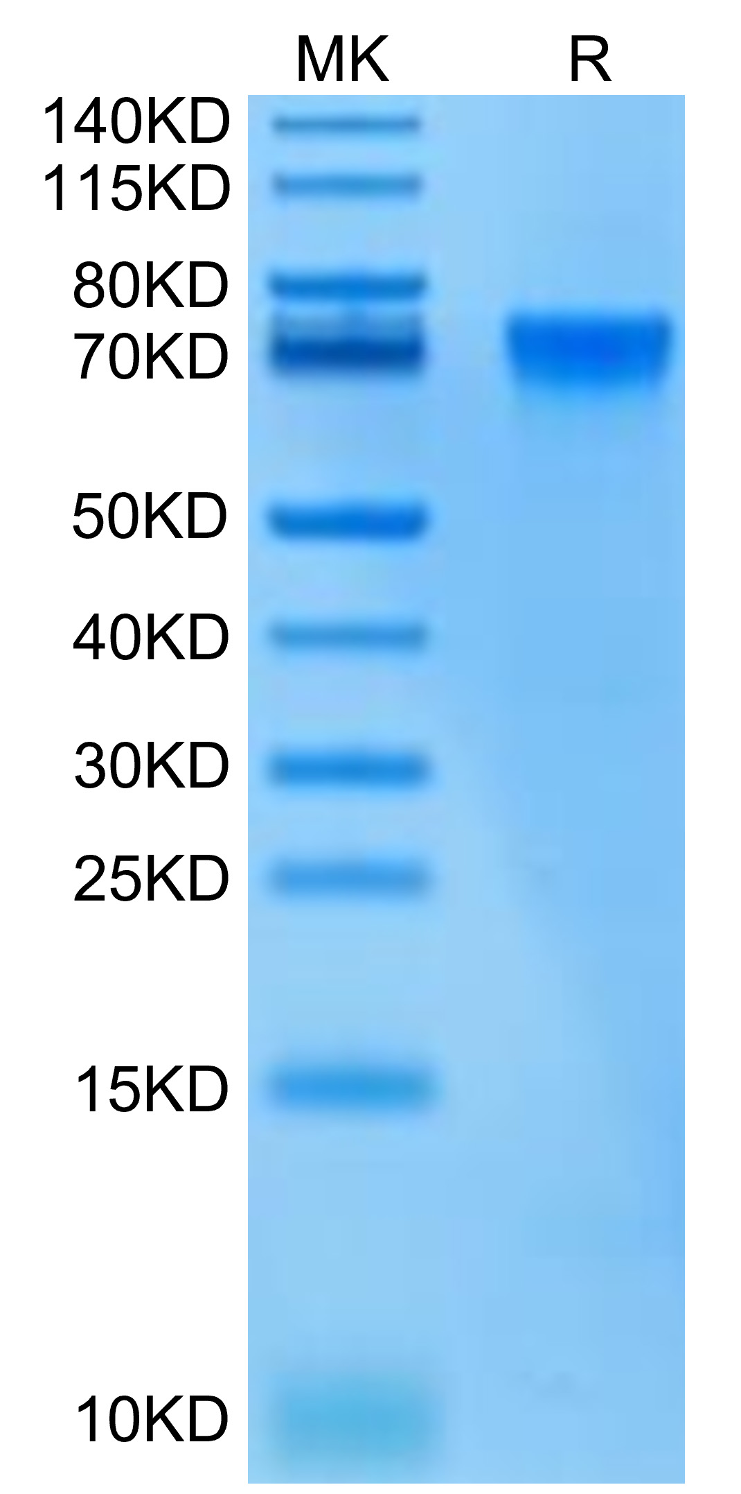 Biotinylated Recombinant Human LILRB2/ILT-4/CD85d Protein