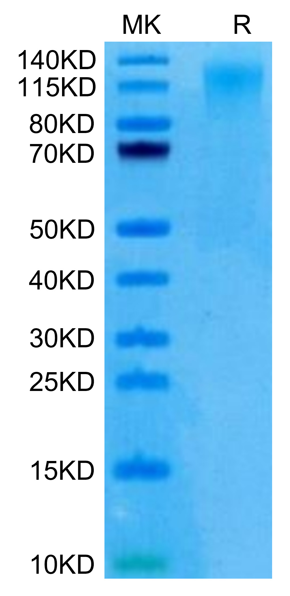 Recombinant Human TACTILE/CD96 (C110S) Protein