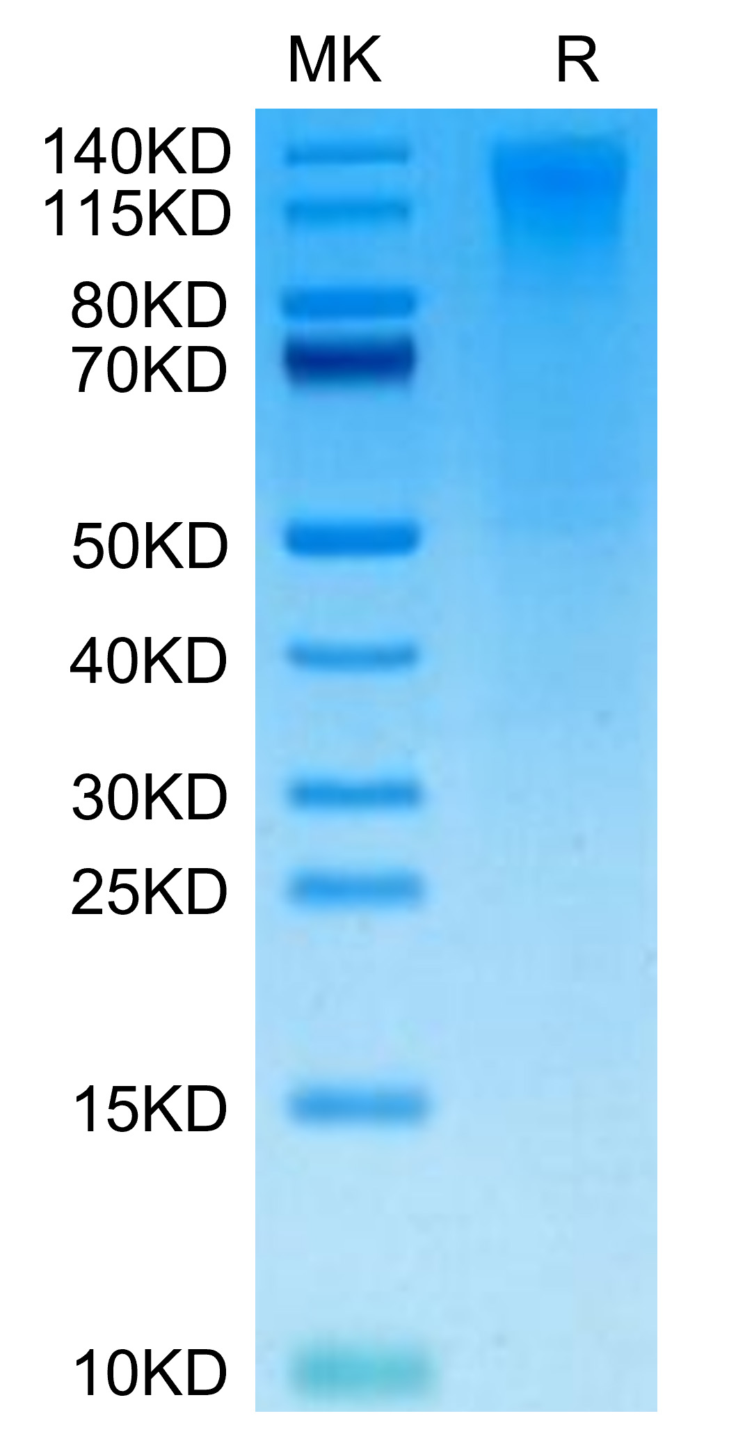 Biotinylated Recombinant Human TACTILE/CD96 Protein