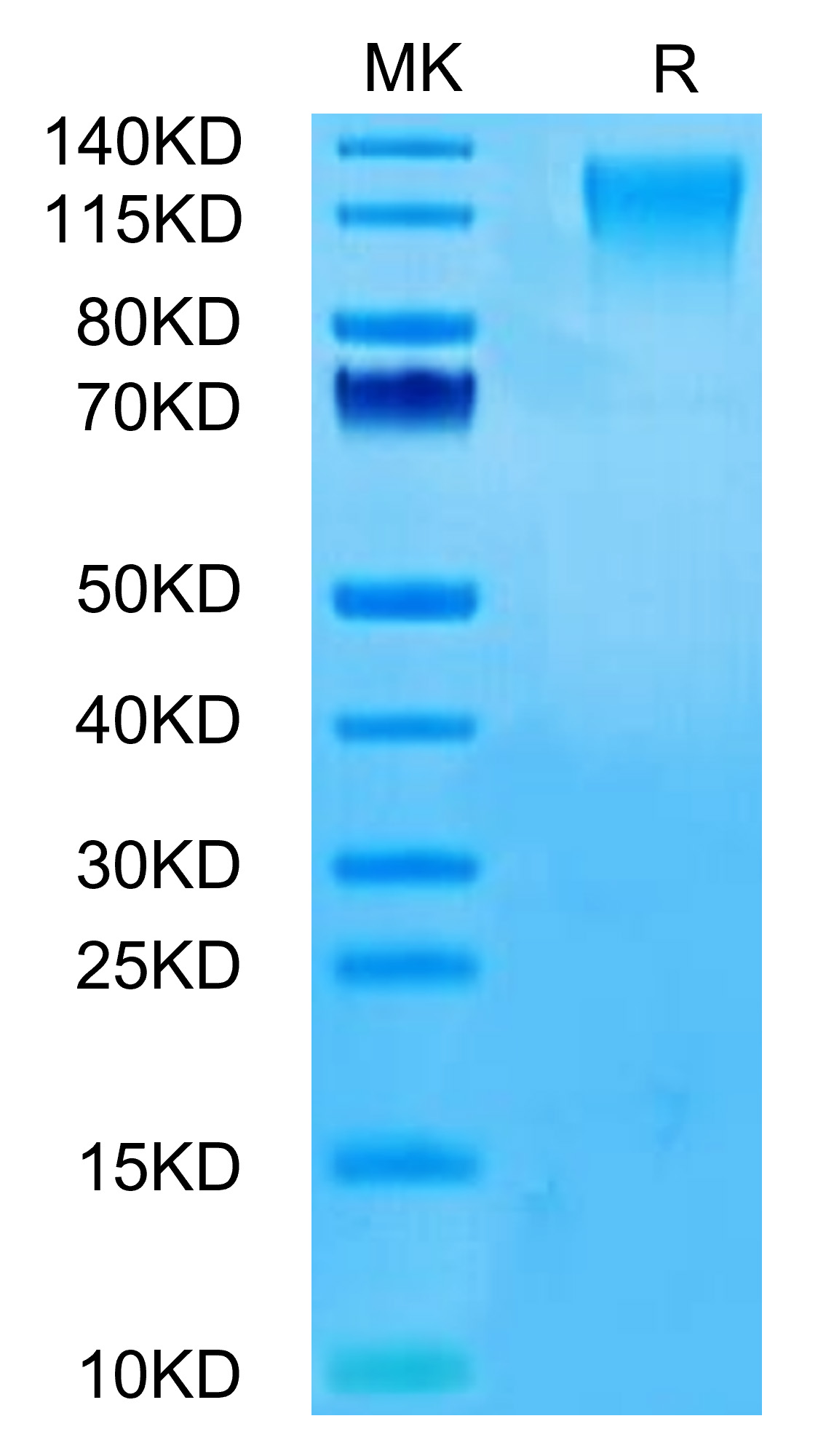 Recombinant Human TACTILE/CD96 Protein