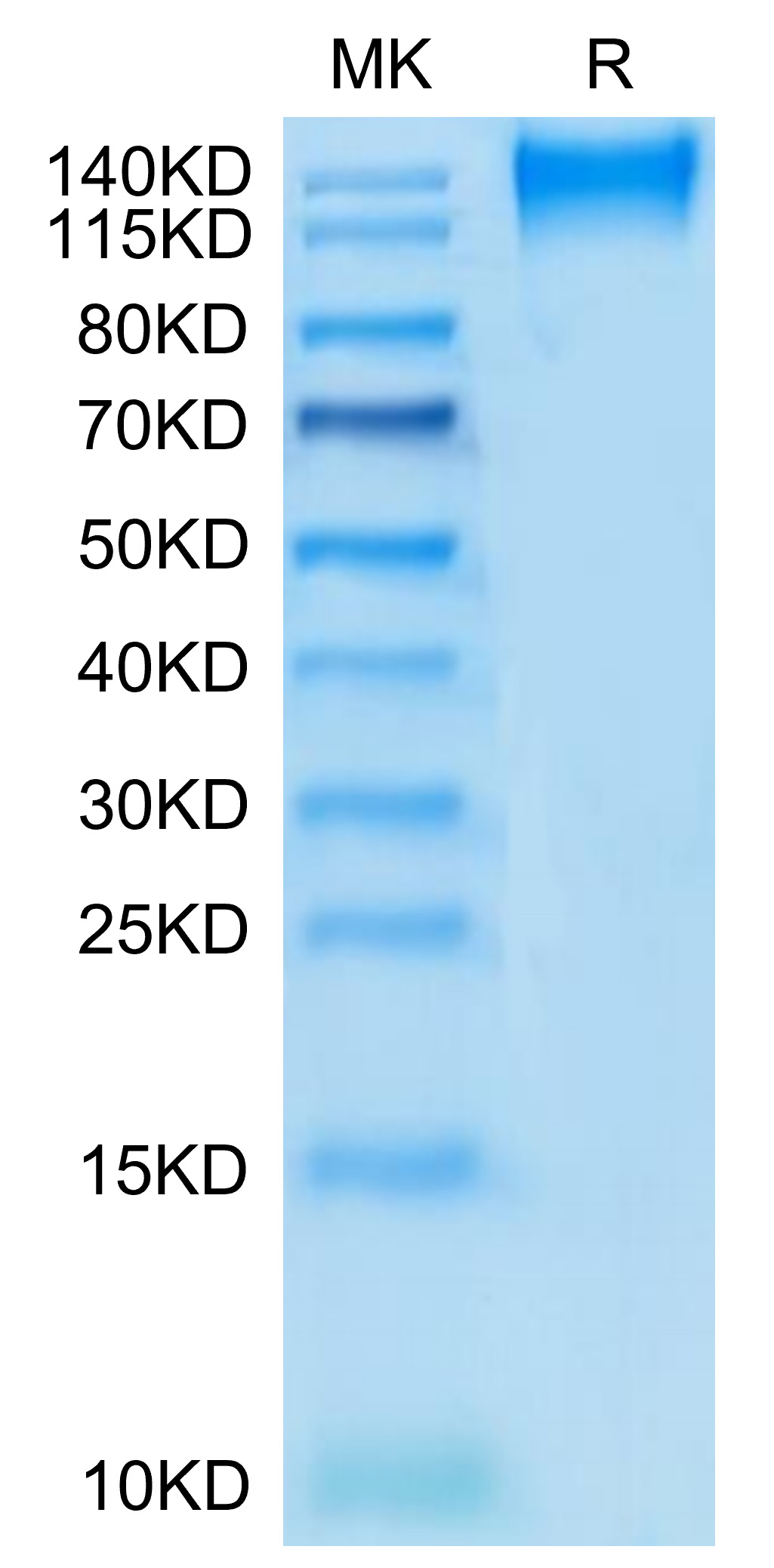 Recombinant Human TACTILE/CD96 Protein