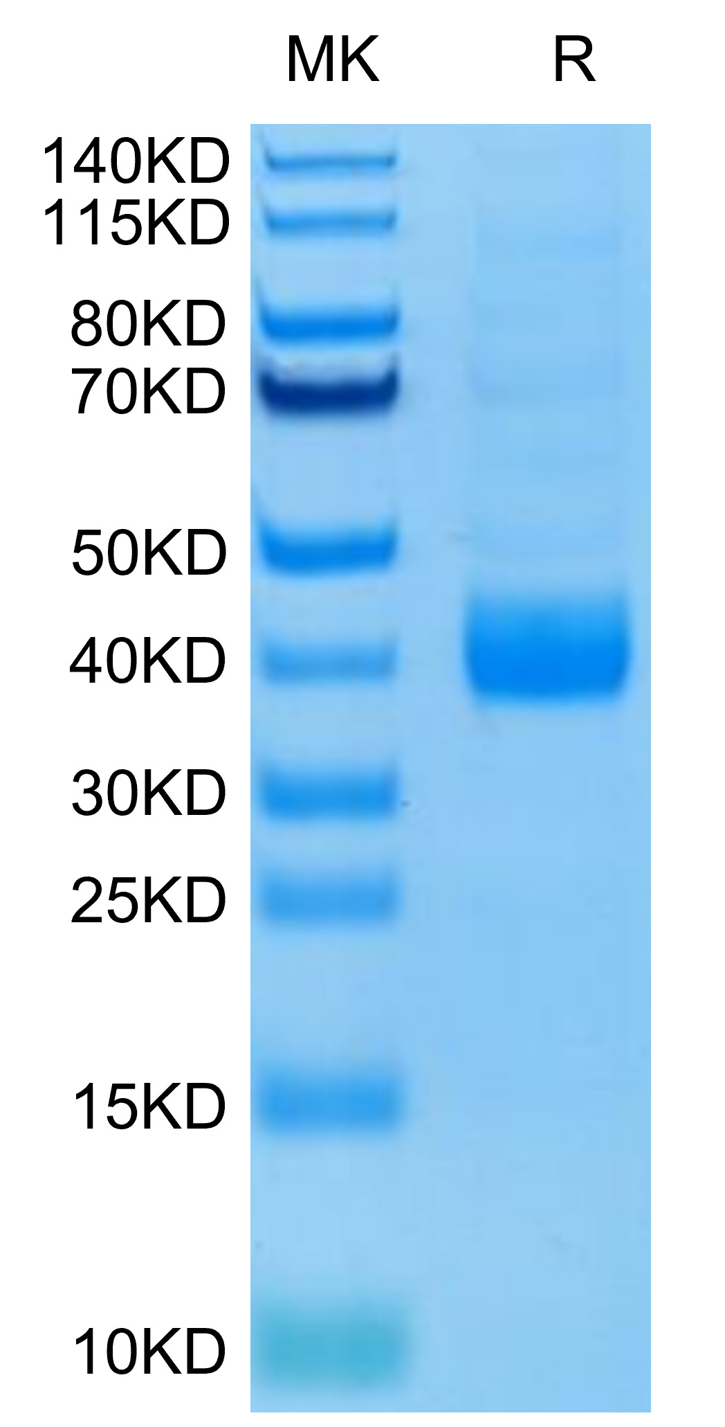 Biotinylated Recombinant Human NKp46/NCR1/CD335 Protein (Primary Amine Labeling)