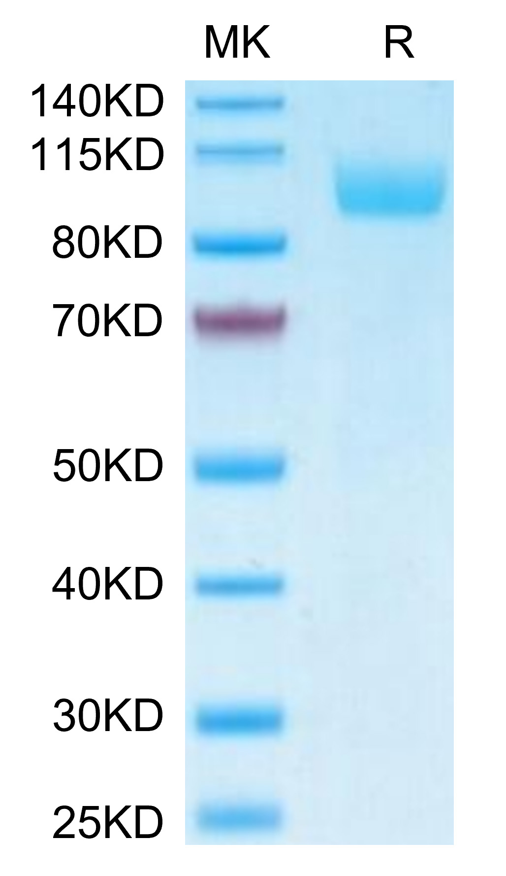 Biotinylated Recombinant Human Siglec-5/CD170 Protein (Primary Amine Labeling)