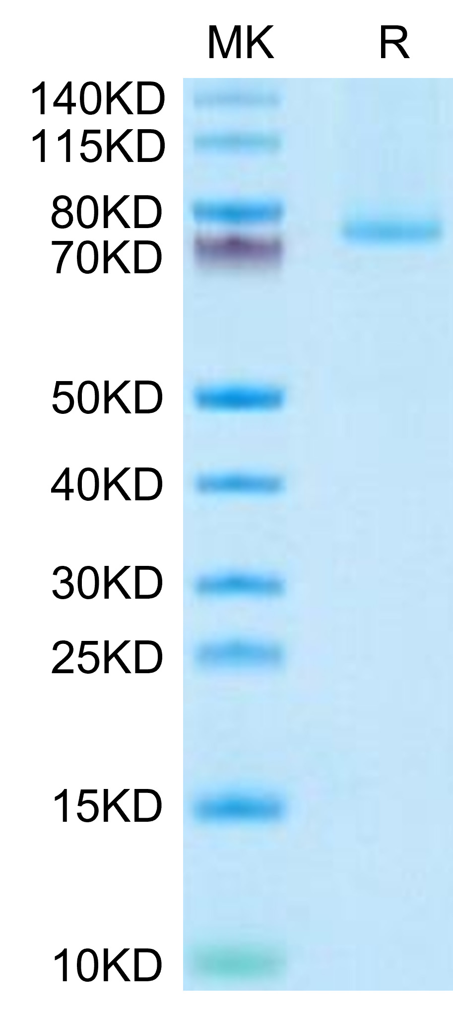 Recombinant Human TNFSF9/4-1BB Ligand Trimer Protein