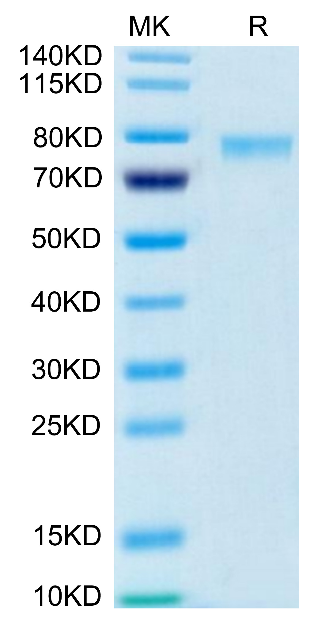 Biotinylated Recombinant Human TNFSF9/4-1BB Ligand Trimer Protein (Primary Amine Labeling)