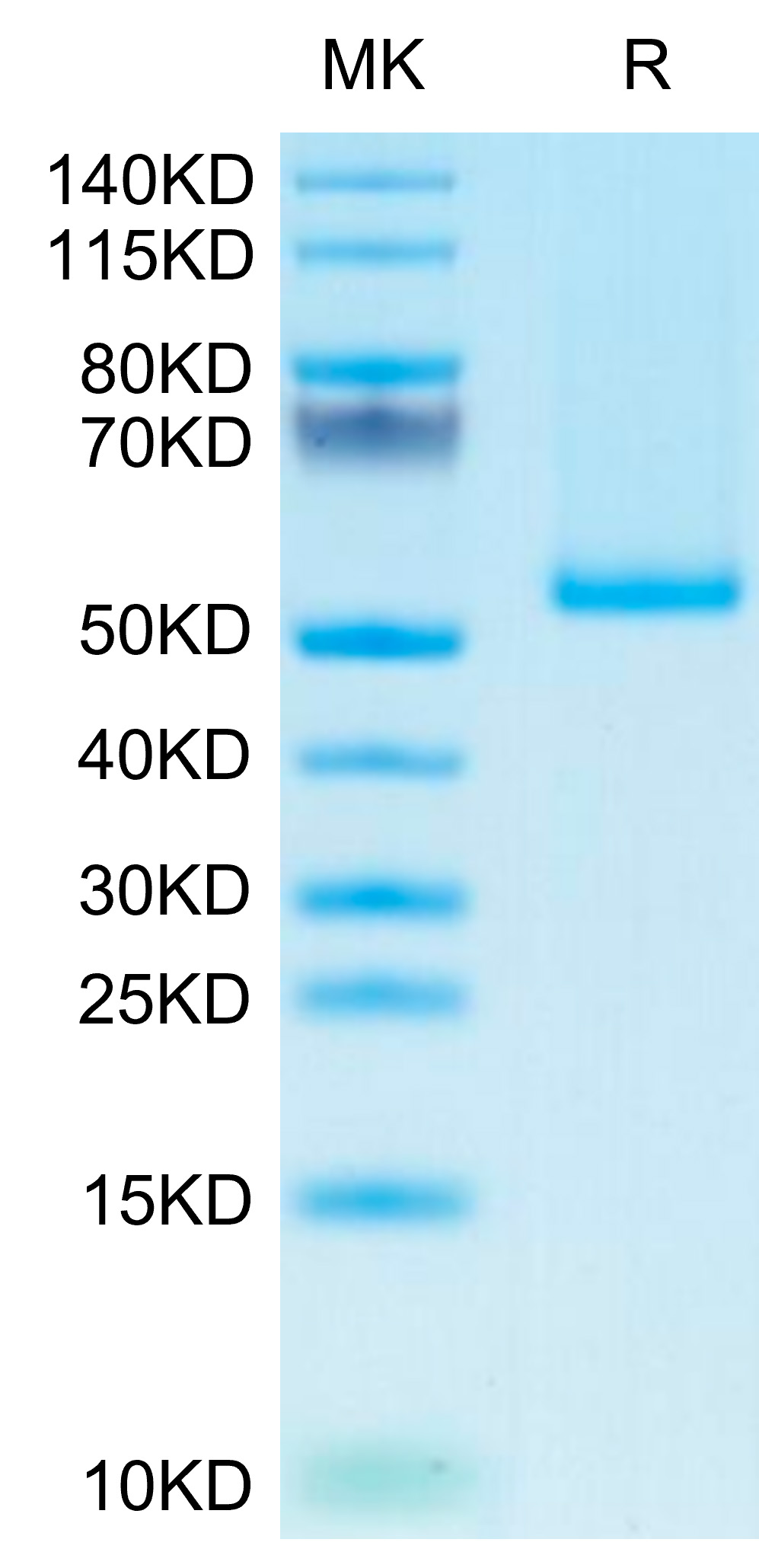 Recombinant Human TNFSF9/4-1BB Ligand Trimer Protein