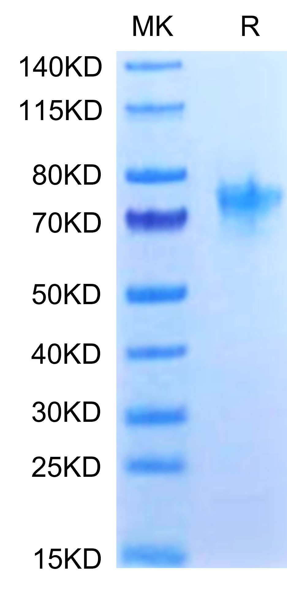 Recombinant Human TNFRSF4/OX40/CD134 Protein