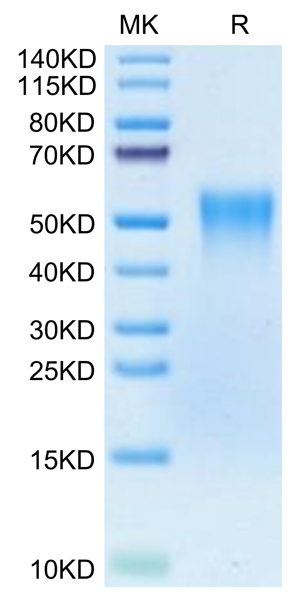 Biotinylated Recombinant Human TNFRSF1B/TNF-R2/CD120b Protein (Primary Amine Labeling)