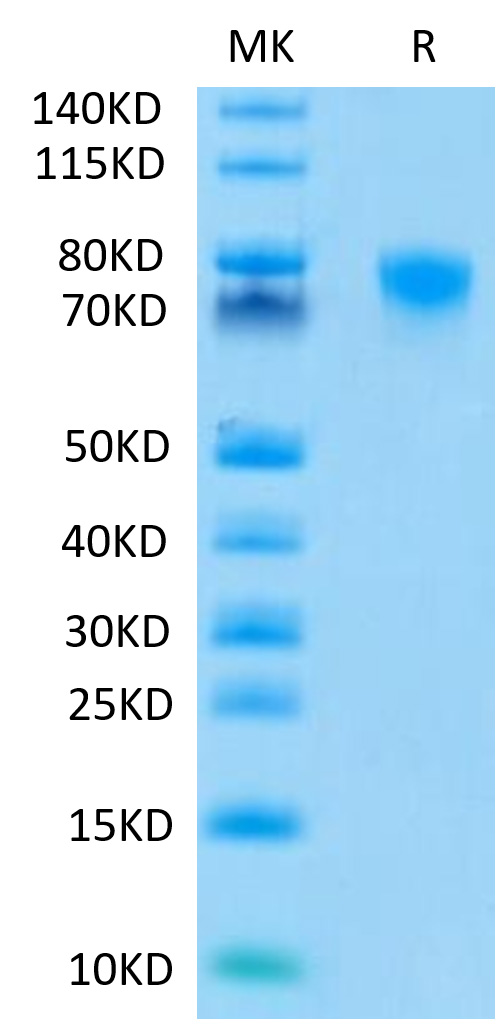 Recombinant Human TNFRSF1B/TNF-R2/CD120b Protein