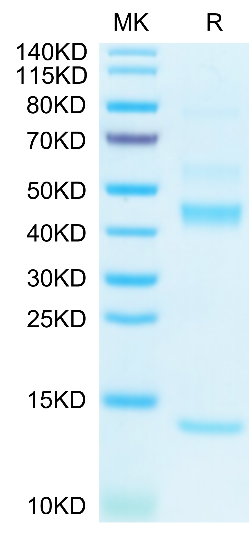 Biotinylated Recombinant Human Latent TGF-beta 1 Protein