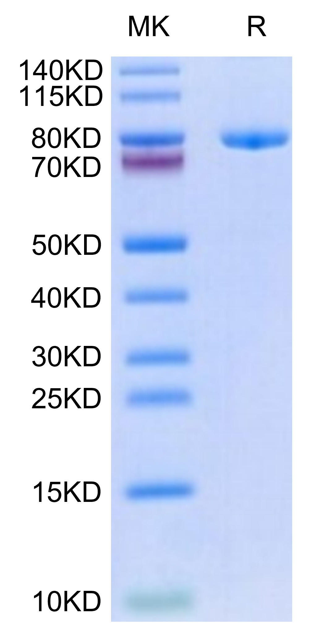 Biotinylated Recombinant Human sTfR/CD71 Protein