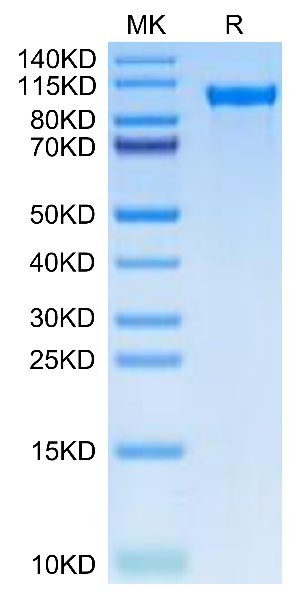 Recombinant Human TIE2/TEK/CD202b Protein