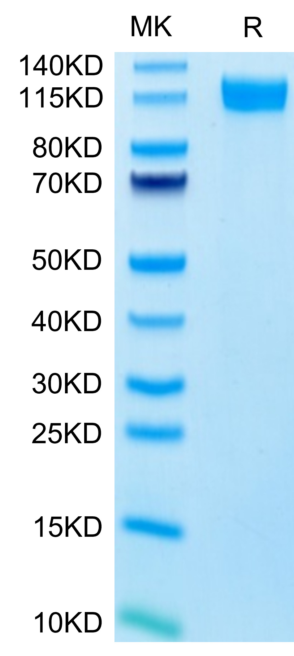 Recombinant Human E-Selectin/SELE/CD62E Protein