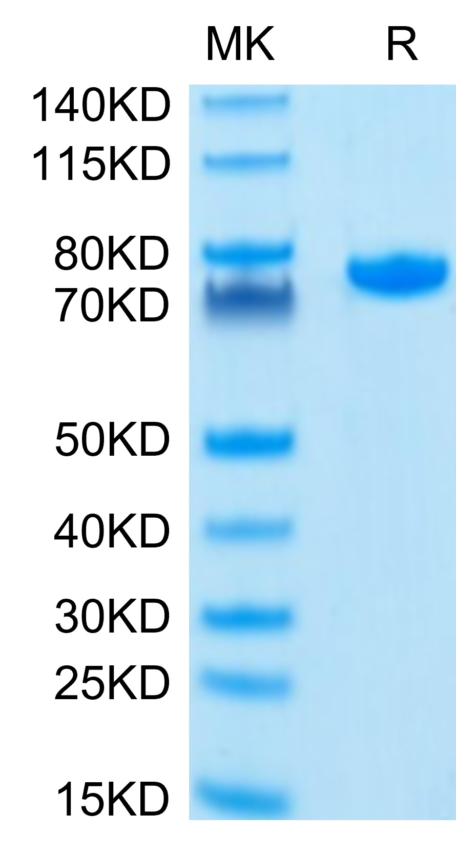 Recombinant Human Nectin-2/PVRL2/CD112 Protein