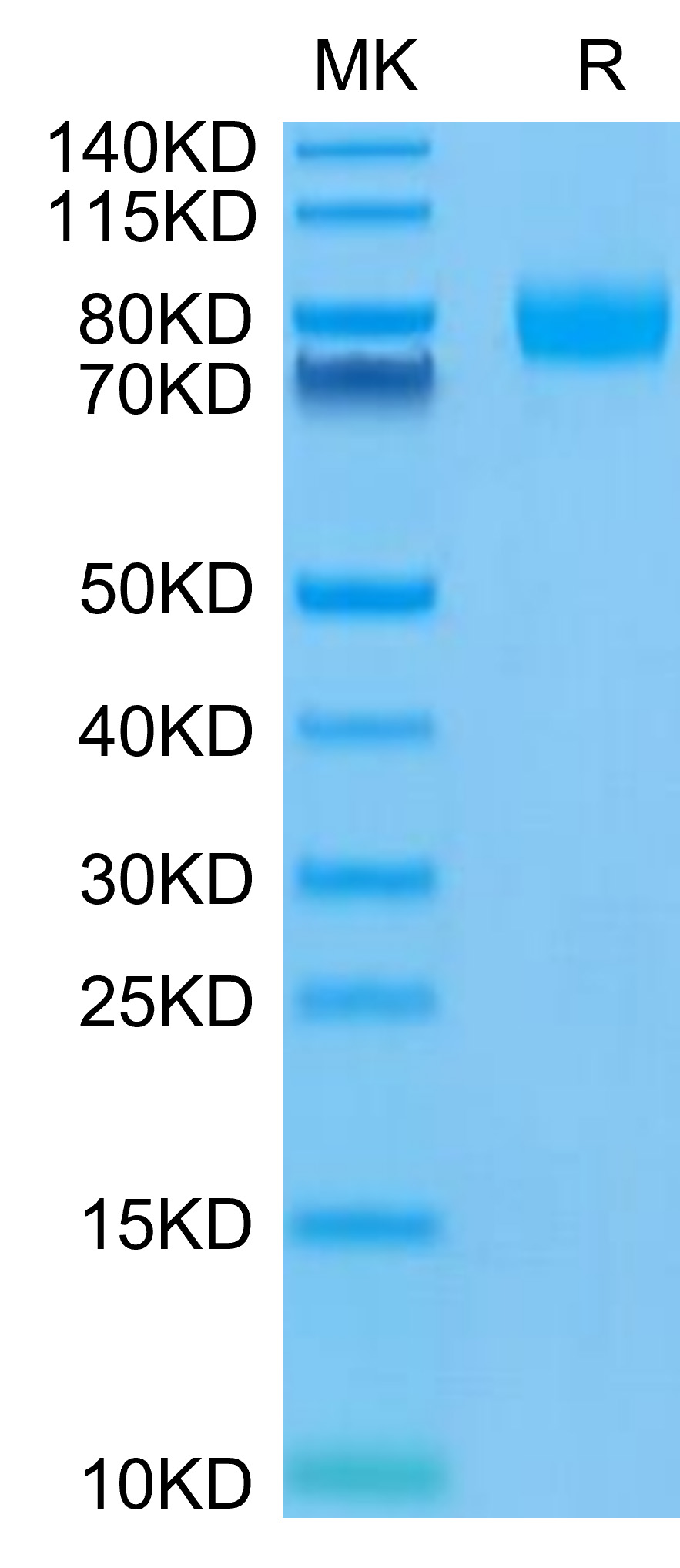 Recombinant Human PVR/CD155 Protein