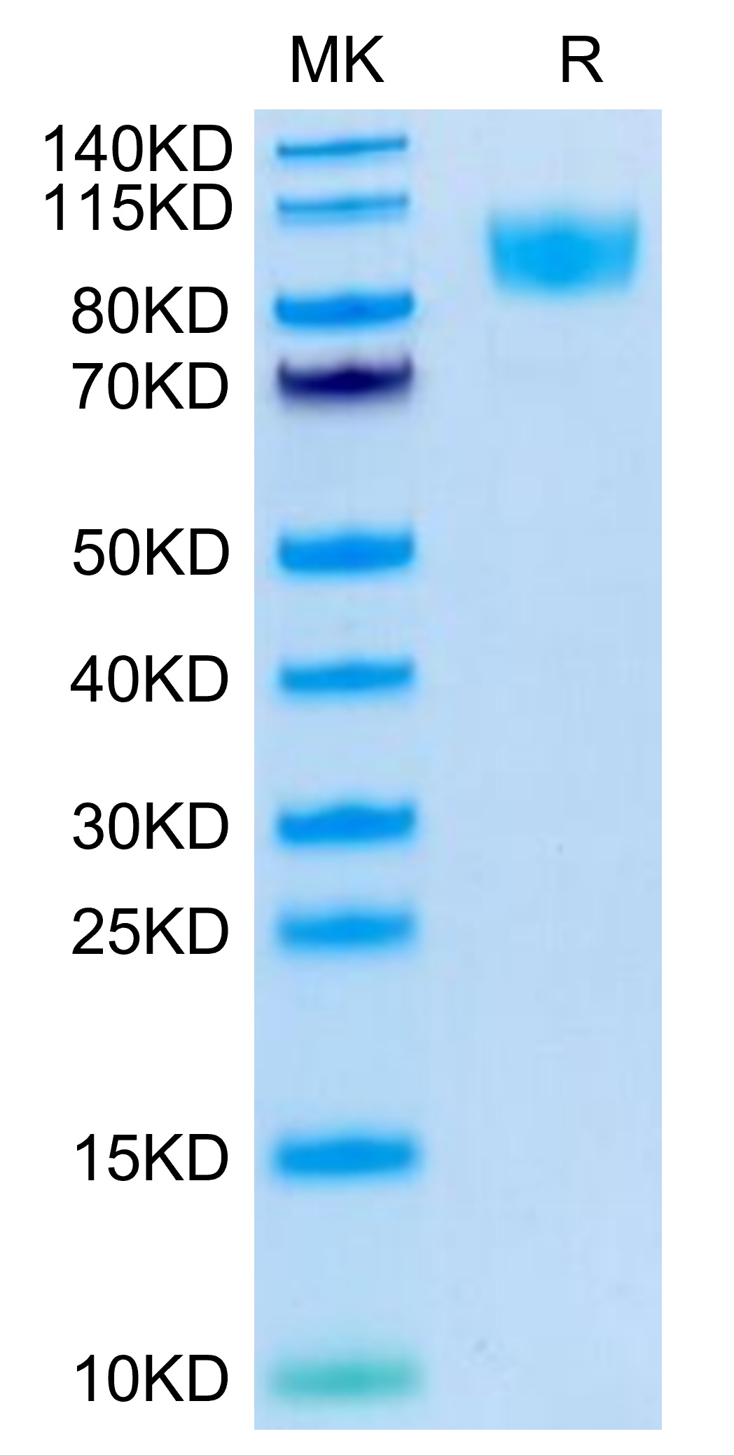 Recombinant Human PTPRC/CD45R0/CD45 Protein