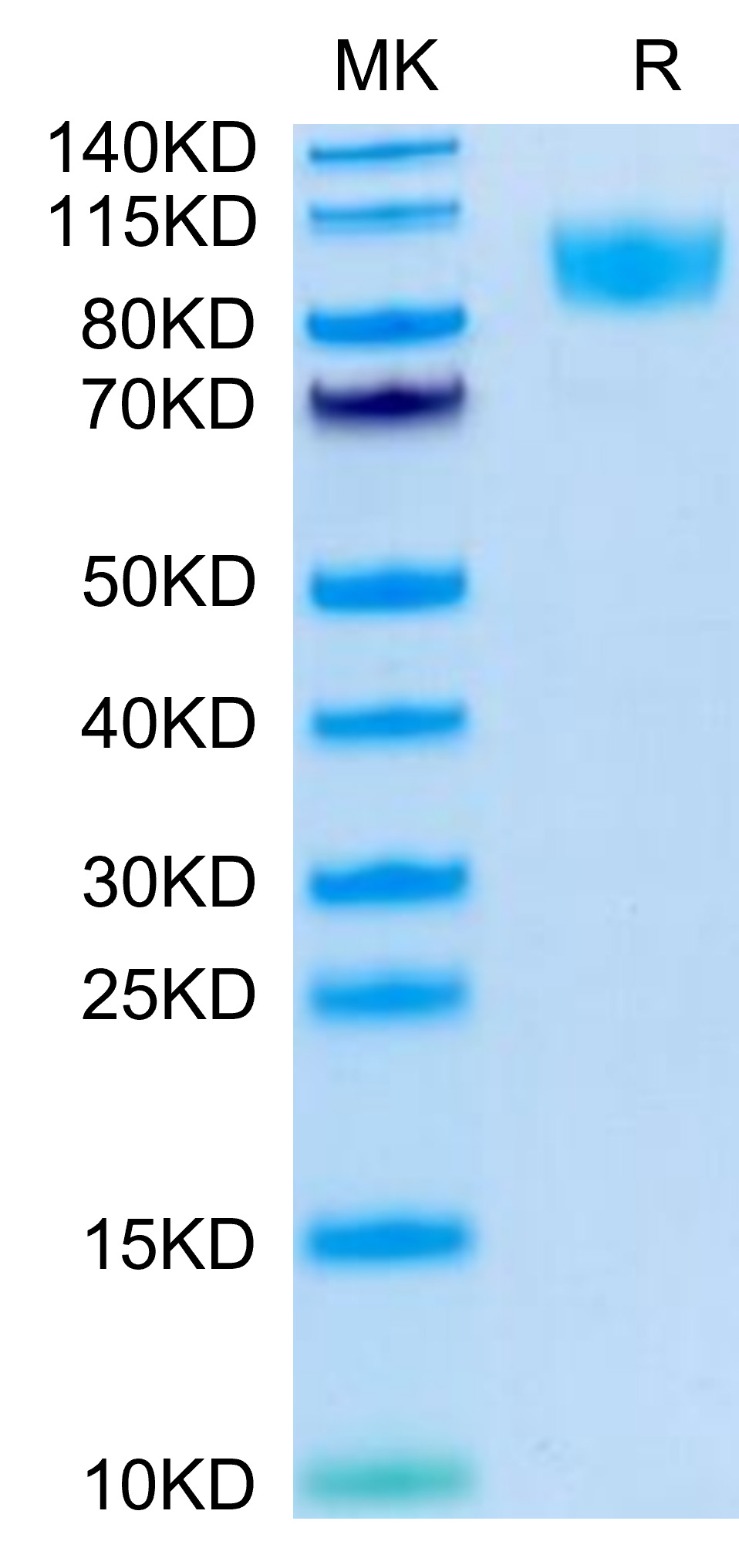 Biotinylated Recombinant Human PTPRC/CD45R0/CD45 Protein