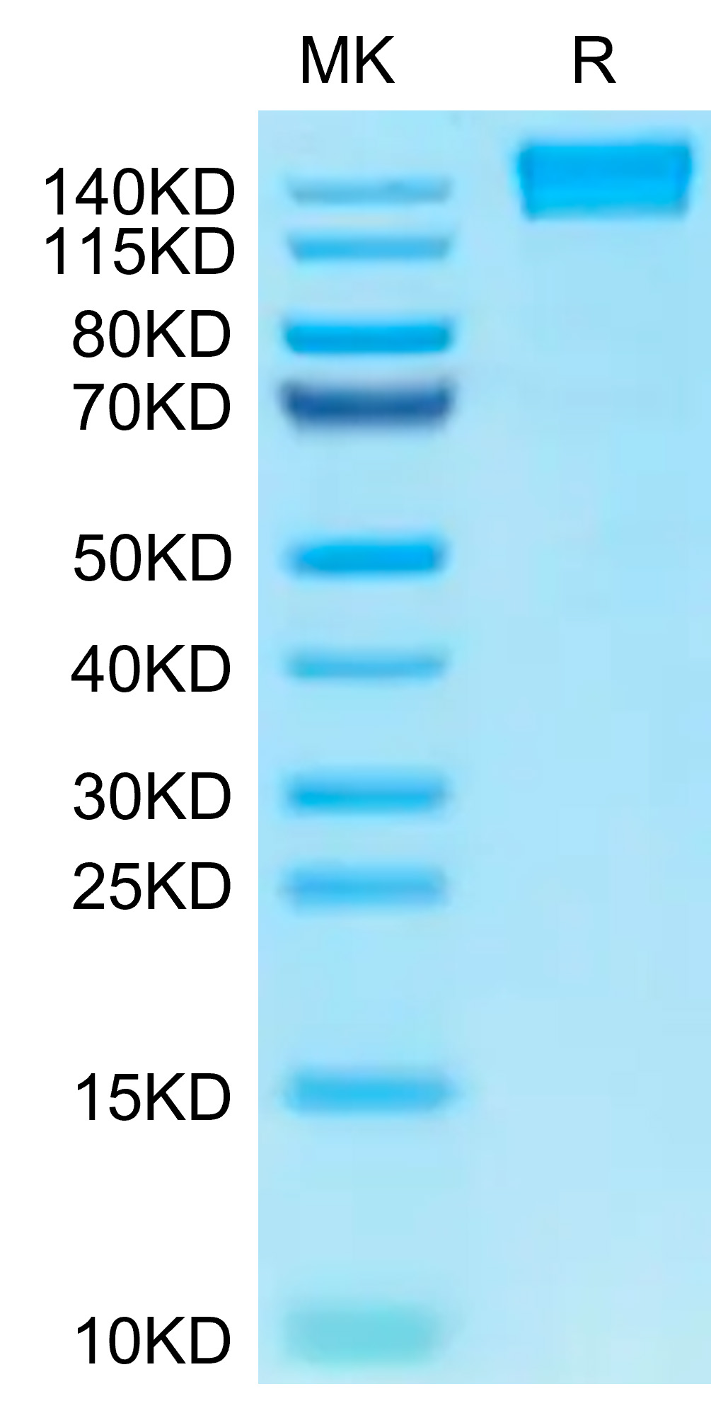 Recombinant Human PTPRC/CD45RABC/CD45 Protein