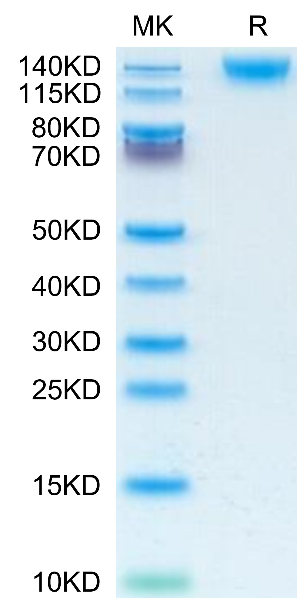 Recombinant Human PTPRC/CD45RABC/CD45 Protein