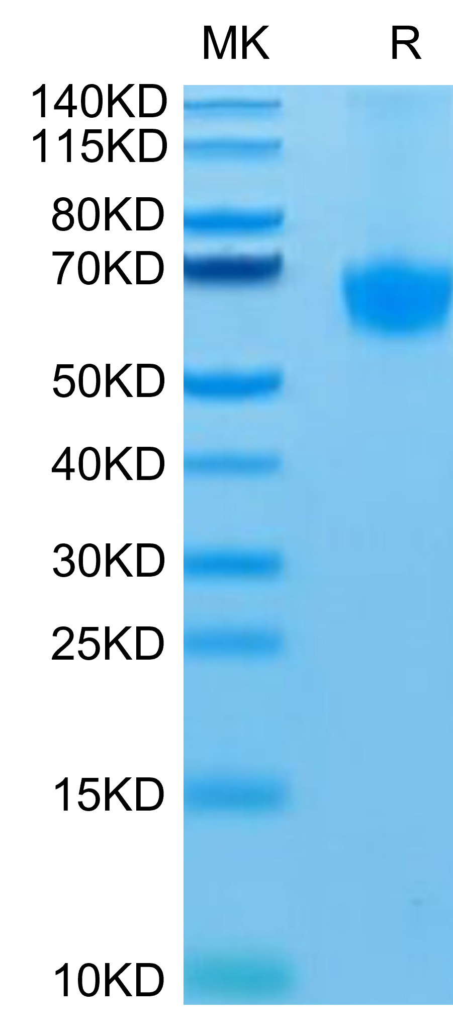 Recombinant Human PD-1/PDCD1/CD279 Protein