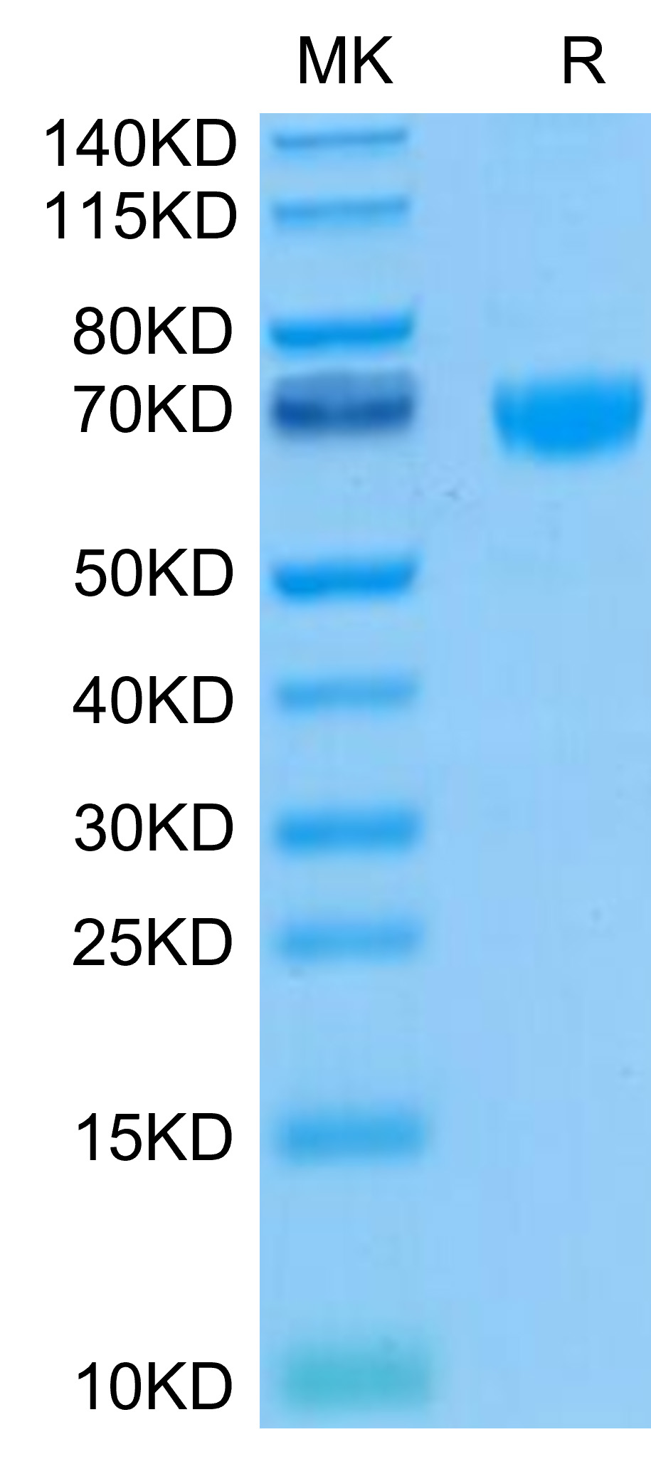 Biotinylated Recombinant Human PD-1/PDCD1/CD279 Protein