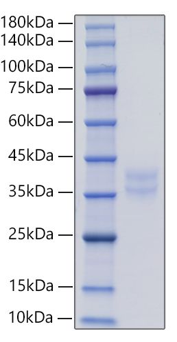 Recombinant Human IL-2RB/CD122 Protein