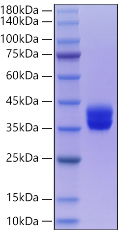 Recombinant Human IL-2RB/CD122 Protein